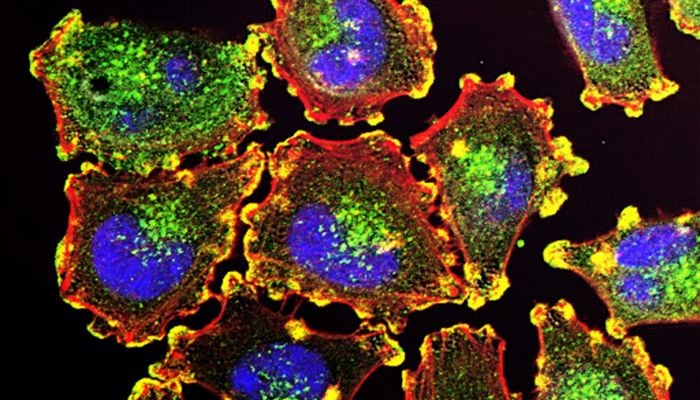 The image shows Metastatic Melanoma Cells. — Unsplash